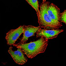 Interleukin-1 Receptor Associated Kinase 3 (IRAK3) Antibody