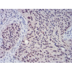 E3 SUMO-Protein Ligase CBX4 (CBX4) Antibody