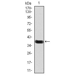 Cell Death Activator CIDE-3 (CIDEC) Antibody