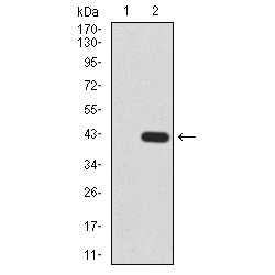 Histone Deacetylase 2 (HDAC2) Antibody