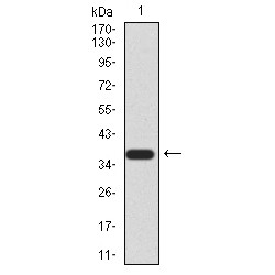 E3 Ubiquitin-Protein Ligase RAD18 (RAD18) Antibody