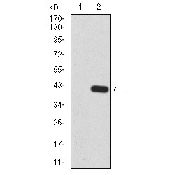 Lysine-Specific Demethylase 5B (KDM5B) Antibody