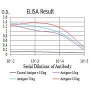 Fig. 1. Black line: Control Antigen (100 ng); Purple line: Antigen(10ng); Blue line: Antigen (50 ng); Red line: Antigen (100 ng)