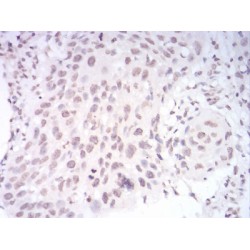 Paired Box Protein Pax-6 (PAX6) Antibody