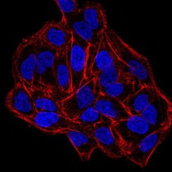 DNA (cytosine-5)-Methyltransferase 3B (DNMT3B) Antibody