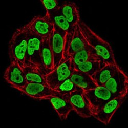 DNA (cytosine-5)-Methyltransferase 3B (DNMT3B) Antibody