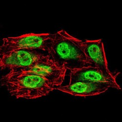 Sirtuin 6 (SIRT6) Antibody