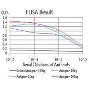 Fig. 1. Black line: Control Antigen (100 ng); Purple line: Antigen(10ng); Blue line: Antigen (50 ng); Red line: Antigen (100 ng)