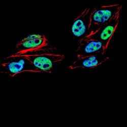 Mismatch Repair Endonuclease PMS2 (PMS2) Antibody