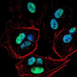 Mismatch Repair Endonuclease PMS2 (PMS2) Antibody