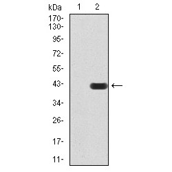 Mismatch Repair Endonuclease PMS2 (PMS2) Antibody