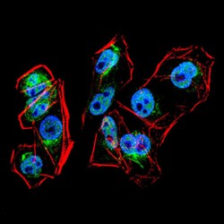 PR Domain Zinc Finger Protein 1 (PRDM1) Antibody