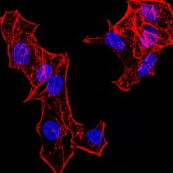 Histone H4 (HIST2H4A (20Me)) Antibody