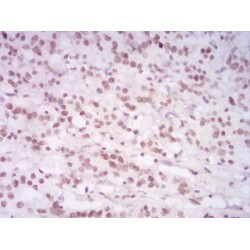 Histone H4 (HIST2H4A (20Me)) Antibody