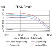 Fig. 1. Black line: Control Antigen (100 ng); Purple line: Antigen(10ng); Blue line: Antigen (50 ng); Red line: Antigen (100 ng)