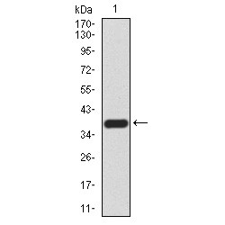Probable ATP-Dependent RNA Helicase DDX20 (DDX20) Antibody
