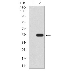 Probable ATP-Dependent RNA Helicase DDX20 (DDX20) Antibody