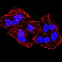 Lysine-Specific Demethylase 4A (KDM4A) Antibody