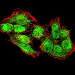 Lysine-Specific Demethylase 4A (KDM4A) Antibody