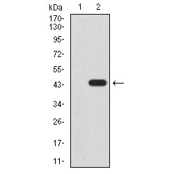 Lysine-Specific Demethylase 4A (KDM4A) Antibody