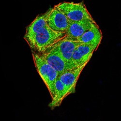 Methyl-CpG-Binding Protein 2 (MECP2) Antibody