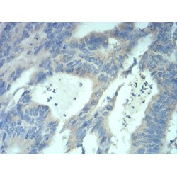 Methyl-CpG-Binding Protein 2 (MECP2) Antibody