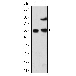 Methyl-CpG-Binding Protein 2 (MECP2) Antibody