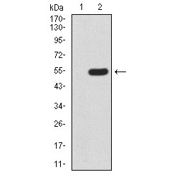 Methyl-CpG-Binding Protein 2 (MECP2) Antibody