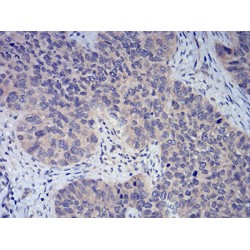 Forkhead Box Protein P3 (FOXP3) Antibody