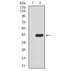 Lysine-Specific Demethylase 2B (FBXL10) Antibody