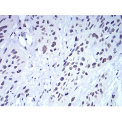 Chromobox Homolog 5 (CBX5) Antibody