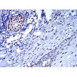 Chromobox Homolog 5 (CBX5) Antibody