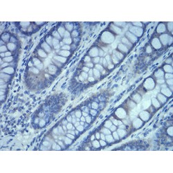 Ras-Related Protein Rab-5A (Rab5a) Antibody