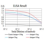 Fig. 1. Black line: Control Antigen (100 ng); Purple line: Antigen(10ng); Blue line: Antigen (50 ng); Red line: Antigen (100 ng)