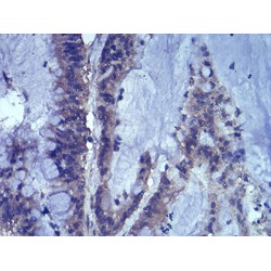 Lymphoid Enhancer-Binding Factor 1 (LEF1) Antibody