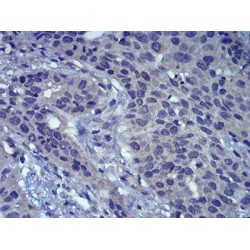 Lymphoid Enhancer-Binding Factor 1 (LEF1) Antibody