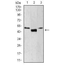 Lymphoid Enhancer-Binding Factor 1 (LEF1) Antibody