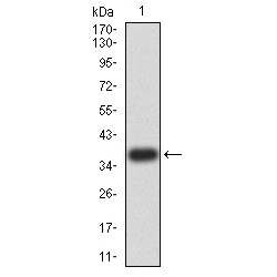 Lymphoid Enhancer-Binding Factor 1 (LEF1) Antibody