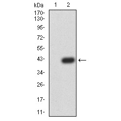 Lymphoid Enhancer-Binding Factor 1 (LEF1) Antibody