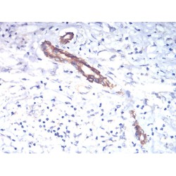 Thyrotropin Subunit Beta (TSHB) Antibody