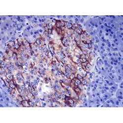 Thyrotropin Subunit Beta (TSHB) Antibody