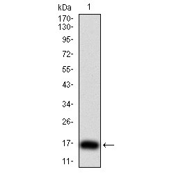 Thyrotropin Subunit Beta (TSHB) Antibody