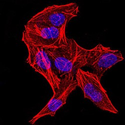 ATP-Dependent RNA Helicase DDX3X (DDX3X) Antibody