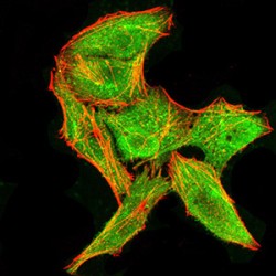 ATP-Dependent RNA Helicase DDX3X (DDX3X) Antibody