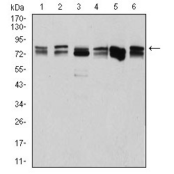 ATP-Dependent RNA Helicase DDX3X (DDX3X) Antibody