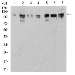 Serine/threonine-Protein Kinase ULK2 (ULK2) Antibody