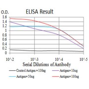 Fig. 1. Figure 1:Black line: Control Antigen (100 ng)Purple line: Antigen (10ng); Blue line: Antigen (50 ng); Red line:Antigen (100 ng)