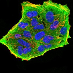 Glutamine Fructose-6-Phosphate Transaminase 1 (GFPT1) Antibody