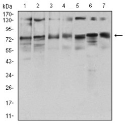 Glutamine Fructose-6-Phosphate Transaminase 1 (GFPT1) Antibody