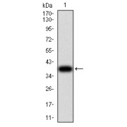 WB analysis of recombinant human RAD21 protein (287-403 AA).